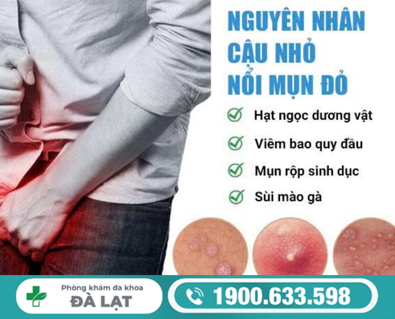Hình ảnh minh họa